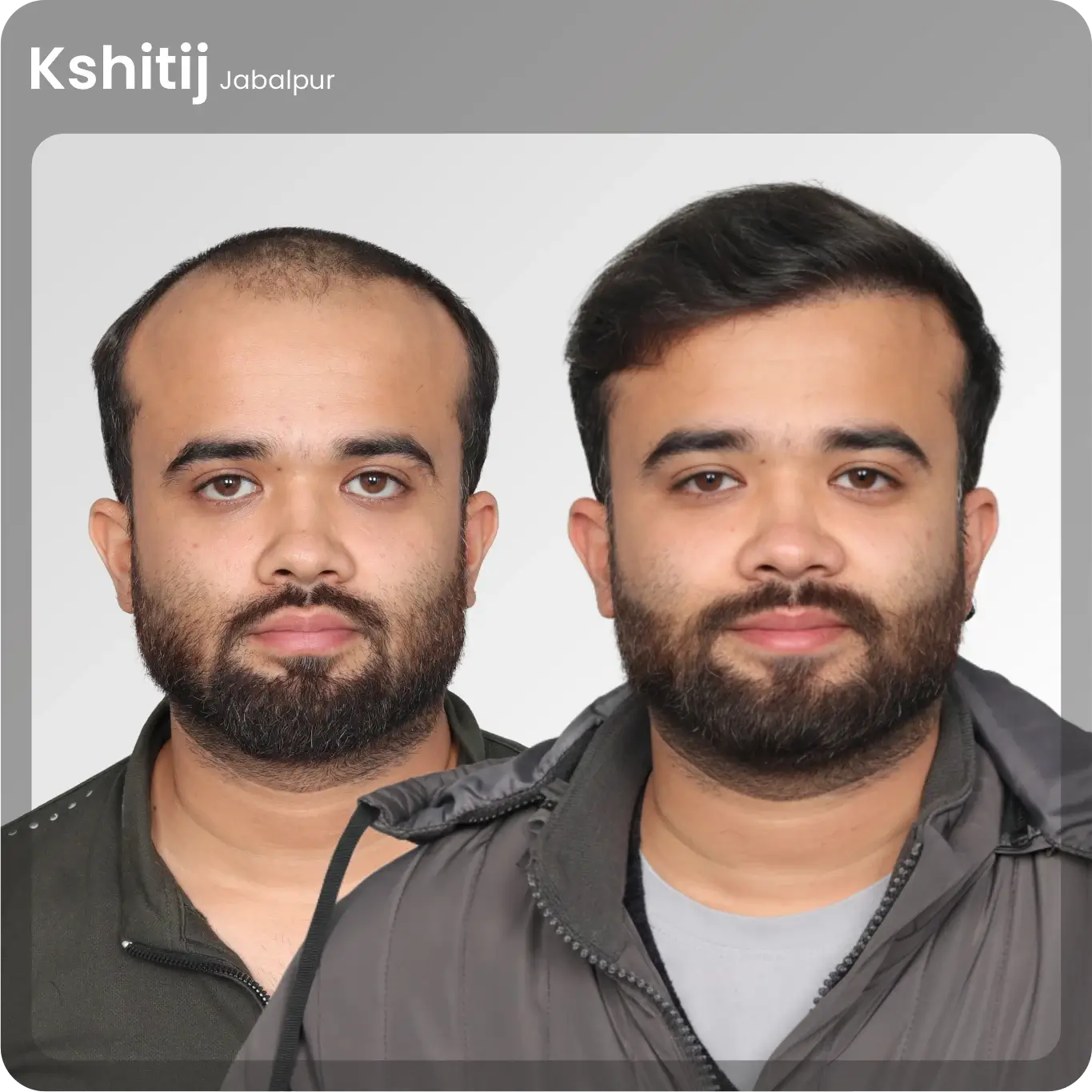 Kshitij